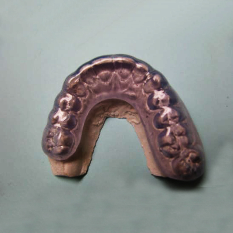 Tala Oclusal