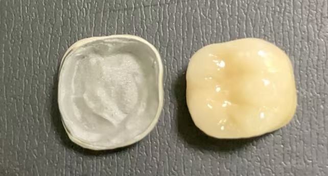 Quais são as condições necessárias para obter coroas de porcelana-fusada para metal?