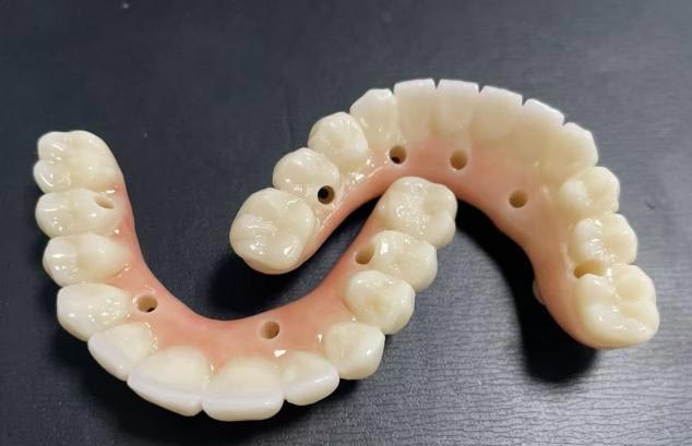 O que é melhor: dentaduras removíveis ou dentaduras fixas?