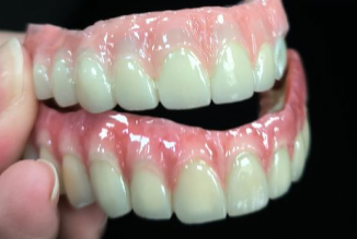 Como lidar com os dentes amarelos?
