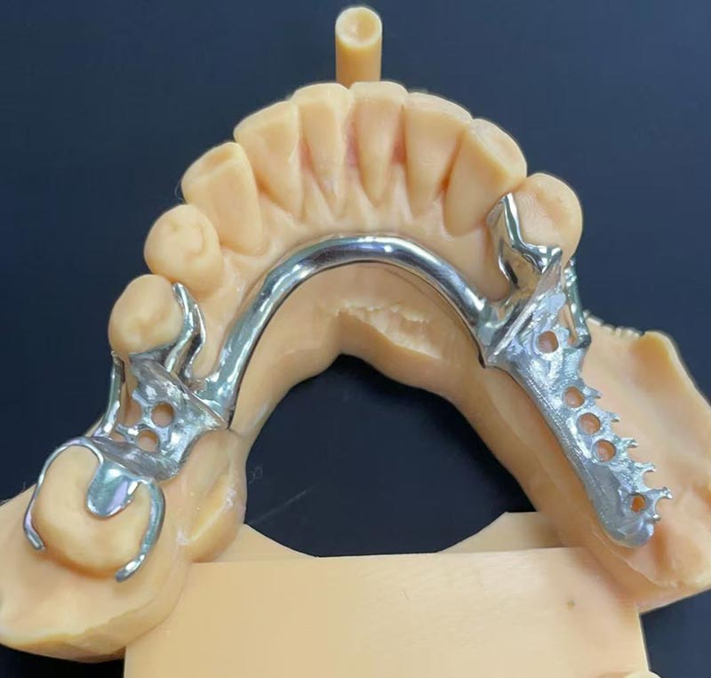 Vantagens da Estrutura Cobalto-Cromo (Estrutura Co Cr)