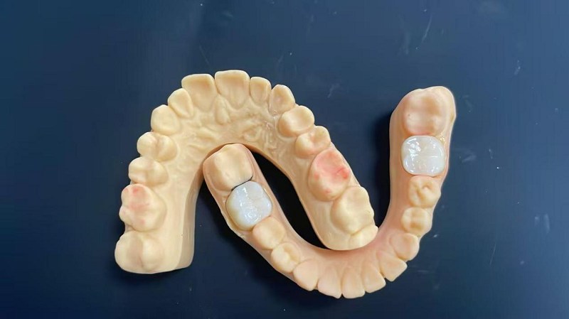 Qual é a borda do ombro?