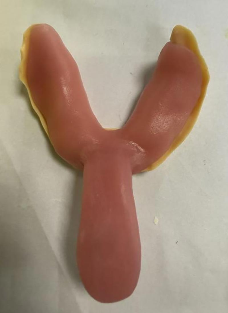 Coisas que você não sabia sobre bandejas dentárias personalizadas