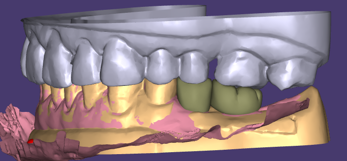 O enceramento estético e as restaurações provisórias do WM Dental Lab são aclamados por unânimes clientes