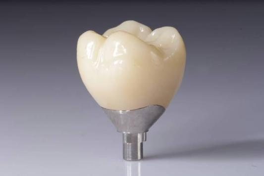 Otimize seus resultados com restaurações de zircônia (coroas, pontes, implantes)