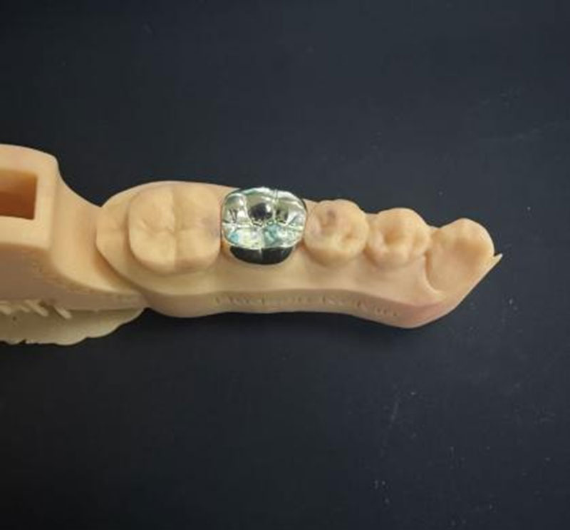 Dentes de Ouro VS Dentes NPG