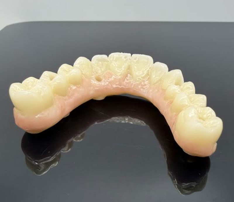 Materiais comuns para coroas e pontes dentárias