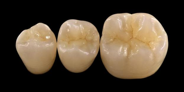 <h2>Zircônia em Odontologia: Indicações, Vantagens e Considerações Clínicas</h2>
<p>A zircônia é amplamente reconhecida por sua resistência e durabilidade. As últimas gerações de materiais de zircônia também oferecem propriedades estéticas significativamente melhoradas. Para pacientes que consideram restaurações totalmente cerâmicas, é essencial avaliar cuidadosamente tanto as indicações quanto as limitações dos sistemas à base de zircônia.</p>
<p>Os pacientes de hoje esperam cada vez mais restaurações que combinem uma excelente estética com um desempenho funcional completo. A maioria dos sistemas cerâmicos modernos pode atender a essas expectativas, mas o sucesso clínico depende em grande parte da seleção adequada do material, do preparo dentário e dos protocolos de cimentação. A escolha deve ser orientada pelas principais propriedades do material, como resistência à fratura, resistência à flexão, resistência ao desgaste e estabilidade a longo prazo. Dentre esses materiais, a zircônia tornou-se uma das opções mais utilizadas na odontologia restauradora contemporânea.</p>
<h3>Por que escolher a Zircônia?</h3>
<p>A zircônia é valorizada por sua resistência excepcional e durabilidade a longo prazo. A zircônia moderna é significativamente diferente das gerações anteriores, que eram mais opacas e menos estéticas. Hoje, a tecnologia CAD/CAM permite a fabricação precisa de restaurações de zircônia com propriedades ópticas aprimoradas.</p>
<p>As restaurações podem ser projetadas como:</p>
<ul>
<li><strong>Zircônia monolítica:</strong>Ideal para coroas e pontes posteriores, oferecendo alta resistência e durabilidade.</li>
<li><strong>Zircônia em camadas:</strong>Adequado para casos que exigem estética aprimorada, incluindo restaurações de longa extensão em diferentes áreas da boca.</li>
</ul>
<p>A resistência à flexão varia dependendo do tipo, variando de aproximadamente 590 MPa na zircônia de alta translucidez até 1400 MPa nas formas monolíticas. As restaurações de zircônia podem ser cimentadas com cimentos resinosos autoadesivos ou cimentos de ionômero de vidro modificados por resina.</p>
<h3>Fatores-chave na seleção de materiais de zircônia</h3>
<p>Ao considerar a zircônia para uma restauração totalmente cerâmica, os médicos devem avaliar vários fatores críticos:</p>
<ul>
<li>Estrutura dentária restante</li>
<li>Localização na cavidade oral (zona estética vs zona funcional)</li>
<li>Presença de hábitos parafuncionais como bruxismo</li>
<li>Translucidez dos dentes naturais adjacentes</li>
<li>Cor e condição da estrutura dentária subjacente</li>
</ul>
<p>A zona estética normalmente inclui os dentes anteriores, embora em alguns pacientes possa se estender até o primeiro molar dependendo da linha do sorriso e da dinâmica facial. A zona funcional geralmente inclui pré-molares e molares, onde as forças oclusais são significativamente maiores.</p>
<h3>Aplicações de Zona Funcional</h3>
<p>Nas regiões posteriores, as forças oclusais devem ser cuidadosamente consideradas. A zircônia é uma excelente alternativa às restaurações tradicionais de MAP, especialmente em casos com espaço restaurador limitado. A zircônia monolítica moderna permite o desenho de contorno completo da anatomia oclusal, incluindo cúspides funcionais e cristas marginais, mantendo ao mesmo tempo alta resistência.</p>
<p>As evidências atuais mostram que a zircônia monolítica é adequada para coroas posteriores e pontes multi-unitárias devido à sua excelente resistência à fratura e ao desgaste. Os avanços nas técnicas adesivas e no design da preparação também melhoraram os resultados clínicos a longo prazo.</p>
<h3>Aplicações da Zona Estética</h3>
<p>Na região anterior, as restaurações devem replicar fielmente a cor natural do dente, a translucidez e o comportamento da luz. Embora materiais como o dissilicato de lítio ofereçam excelente estética, eles são menos resistentes e normalmente requerem ligação adesiva.</p>
<p>Uma das principais vantagens da zircónia é a sua capacidade de ser cimentada convencionalmente e, ao mesmo tempo, alcançar um elevado desempenho estético. Com o desenvolvimento de sistemas de zircônia de alta translucidez e multicamadas, agora é possível produzir restaurações que imitam de perto a dentição natural.</p>
<p>Técnicas avançadas de processamento melhoram ainda mais as propriedades ópticas e reduzem imperfeições que podem afetar a transmissão e a aparência da luz.</p>
<h3>Força e estética combinadas</h3>
<p>Os primeiros sistemas de zircônia priorizavam a resistência, mas careciam de qualidade estética. A zircônia monolítica moderna combina com sucesso resistência e aparência aprimorada, tornando-a adequada para uma ampla variedade de casos clínicos.</p>
<p>É particularmente benéfico para pacientes com hábitos parafuncionais ou falhas de restauração anteriores. Estudos clínicos indicam alta aceitação do paciente e baixas taxas de complicações.</p>
<p>As preocupações relativas ao desgaste na dentição oposta foram reduzidas com as formulações mais recentes. Superfícies de zircônia altamente polidas demonstram baixo potencial abrasivo e, em alguns casos, podem ser mais suaves do que as restaurações tradicionais de porcelana fundida com metal.</p>
<h3>Implantes de zircônia: alternativa emergente</h3>
<p>Embora os implantes de titânio continuem sendo o padrão clínico, os implantes de zircônia estão ganhando atenção como uma alternativa livre de metal. Os primeiros projetos eram principalmente sistemas de peça única, mas os implantes de zircônia de duas peças agora permitem maior flexibilidade protética.</p>
<p>Os implantes de zircónia são particularmente úteis em casos onde existem preocupações estéticas, tais como potencial descoloração cinzenta dos tecidos peri-implantares ou biótipo gengival fino. Eles também podem ser considerados para pacientes com rara sensibilidade ao titânio.</p>
<p>No entanto, os implantes de zircónia ainda são relativamente novos e os dados clínicos a longo prazo permanecem limitados em comparação com os sistemas de titânio.</p>
<h3>Conclusão</h3>
<p>A zircônia evoluiu para um material altamente versátil em odontologia restauradora, oferecendo um forte equilíbrio entre desempenho mecânico e estética. A seleção adequada dos casos e a adesão aos protocolos clínicos são essenciais para alcançar resultados ideais em aplicações anteriores e posteriores.</p>